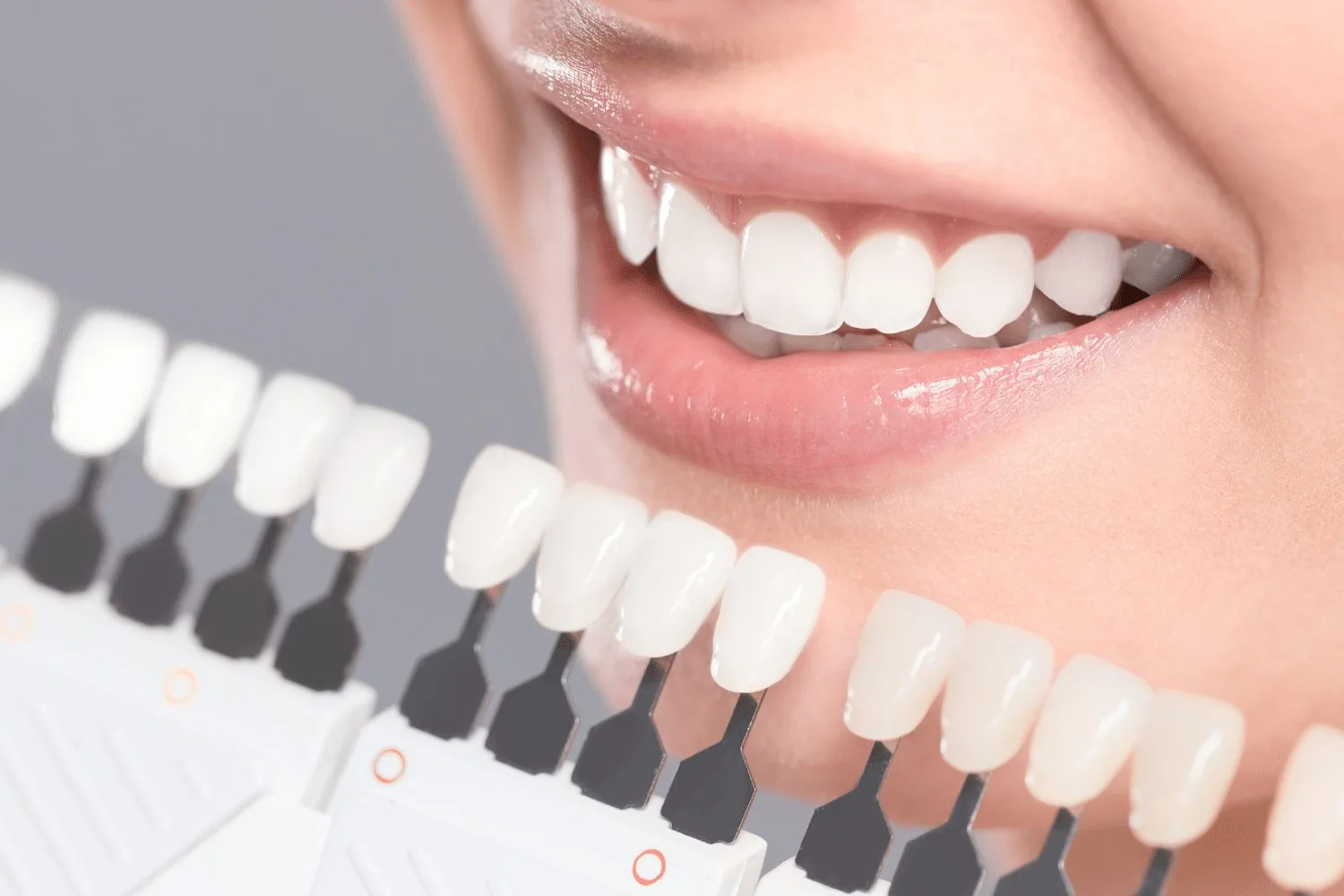 Estética dental y diseño de sonrisa en Clínica A+ Salud, Concepción